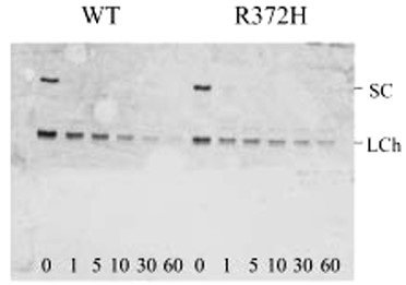 Anti-Factor VIII Antibody - image 1