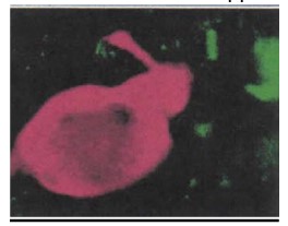 Anti-Gonadotropin Releasing Hormone Antibody - image 1